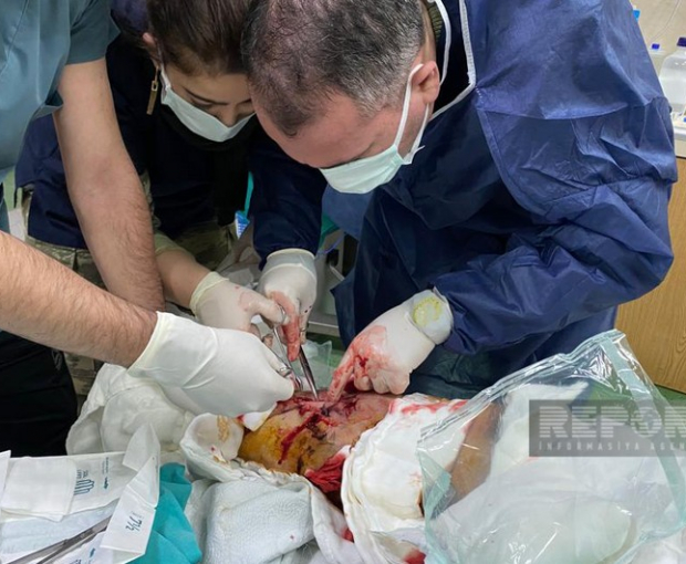 Азербайджанские врачи принимают активное участие в эвакуации пострадавших в ходе землетрясения в Турции