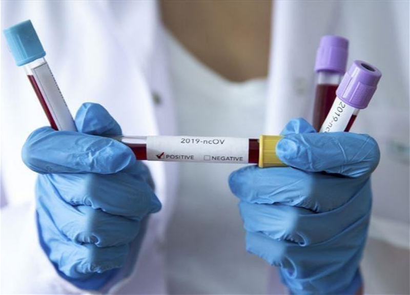 В Азербайджане за прошедшую неделю коронавирусом заразились 156 человек - ФОТО