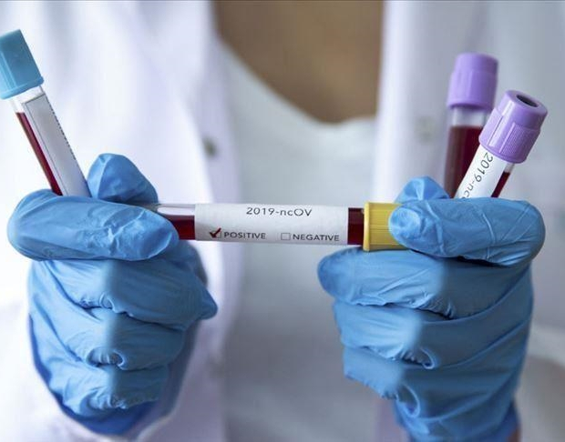 В Азербайджане за прошедшую неделю коронавирусом заразились 45 человек - ФОТО