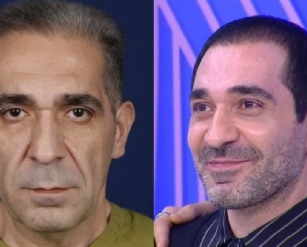 Похудевший на 40 кг азербайджанский певец преобразился после пластической операции - ФОТО