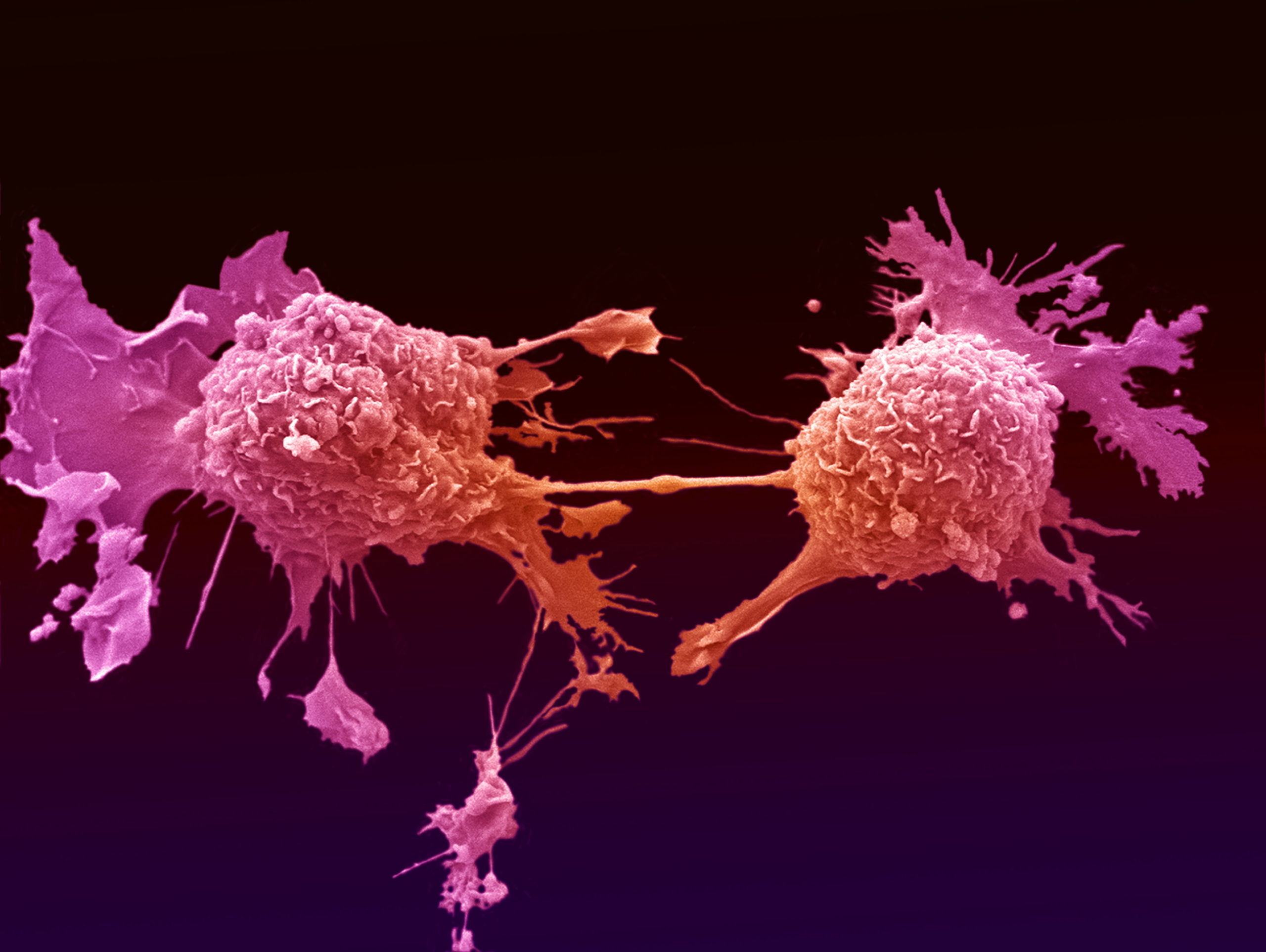 Ученые нашли новое слабое место раковых клеток