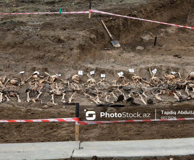 В массовом захоронении в Ходжалы найдены останки еще 5 человек