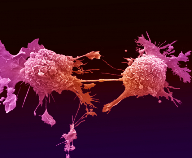 Ученые нашли новое слабое место раковых клеток