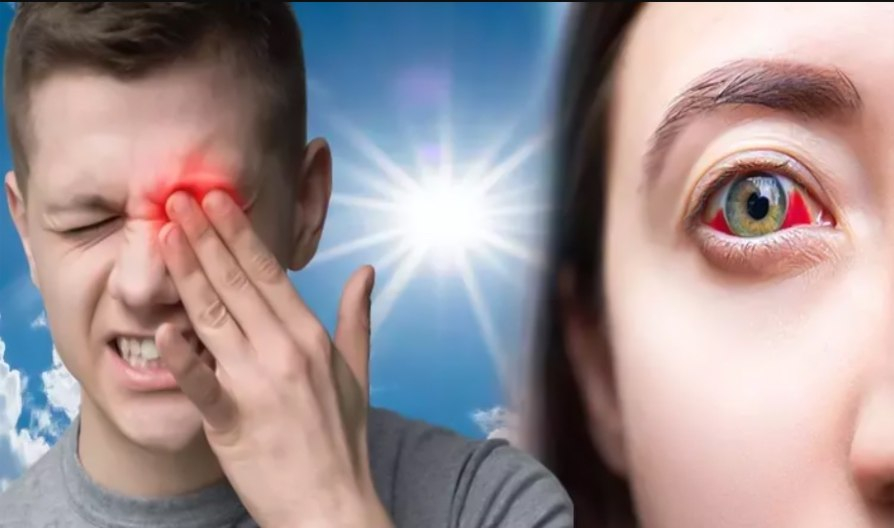 Солнечное излучение может привести к раку глаза